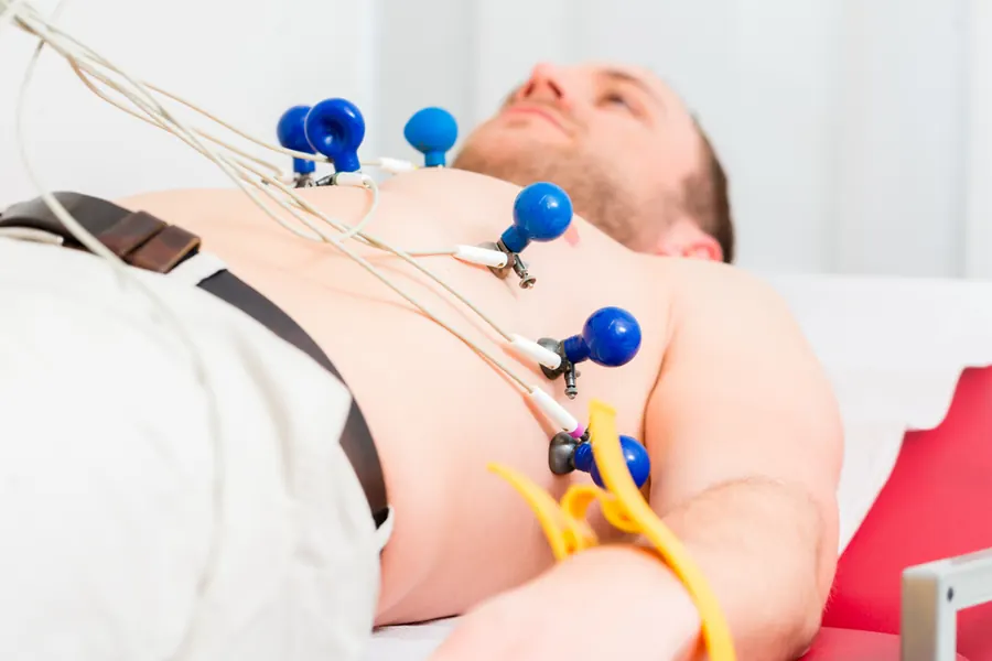 Elektrokardiyografi (EKG)